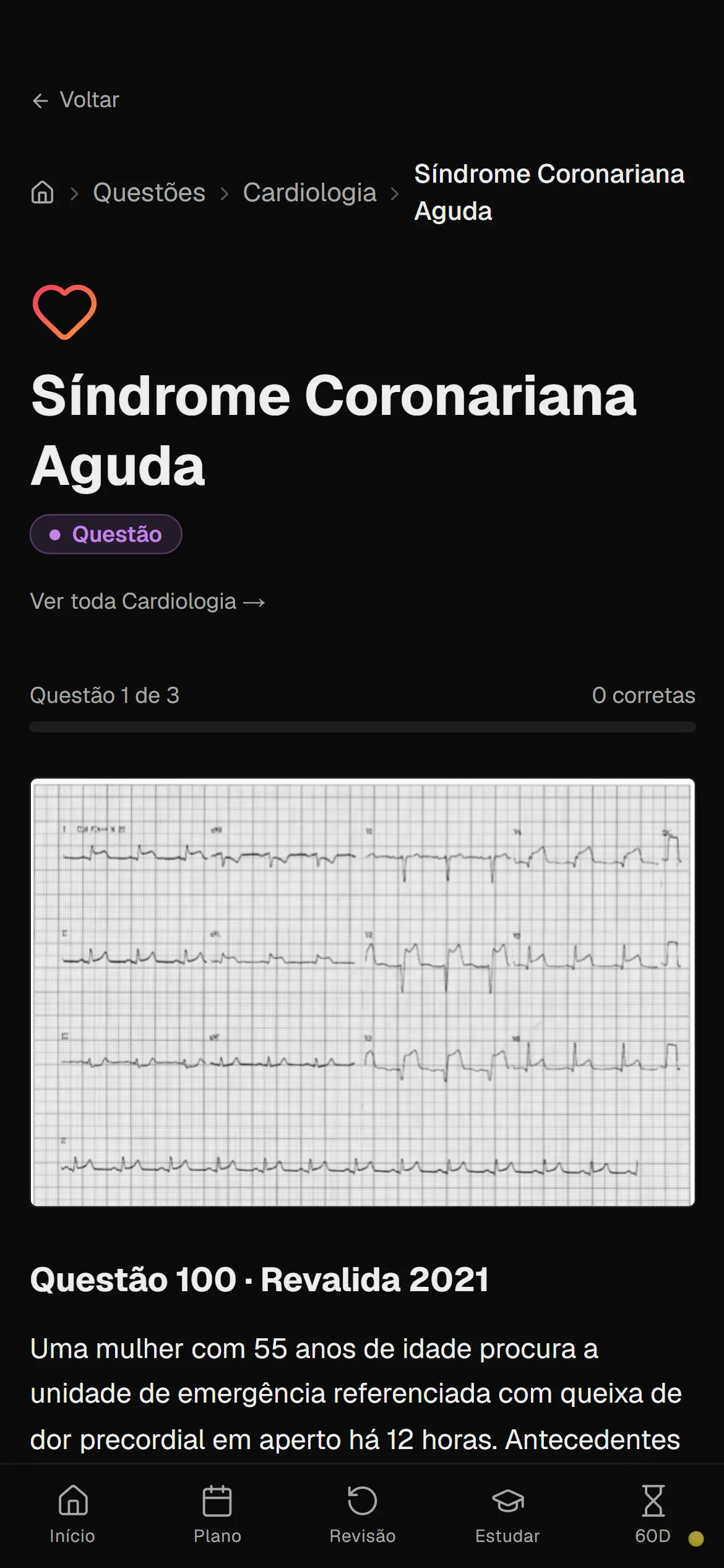 Tela de uma questão de cardiologia com ECG e enunciado no estilo Revalida.